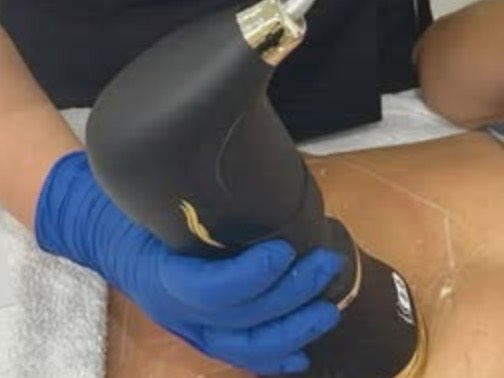 Aplicador de HIFU a tratar o corpo